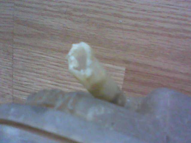 thumb